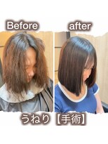 エテルネ 大宮店(E:terne)&nbsp;うねり手術