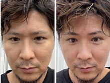 セピア 浦和店(SEPIA)の雰囲気（お肌や眉などのお悩みも解決いたします。カウンセリングに定評！）