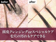 アイスタイル 藤三陽光台店(I STYLE)の雰囲気（白髪染めをしながら髪だけじゃなく頭皮もケア［頭皮改善/白髪］）