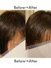 【当日施術OK】無料相談｜何本必要？