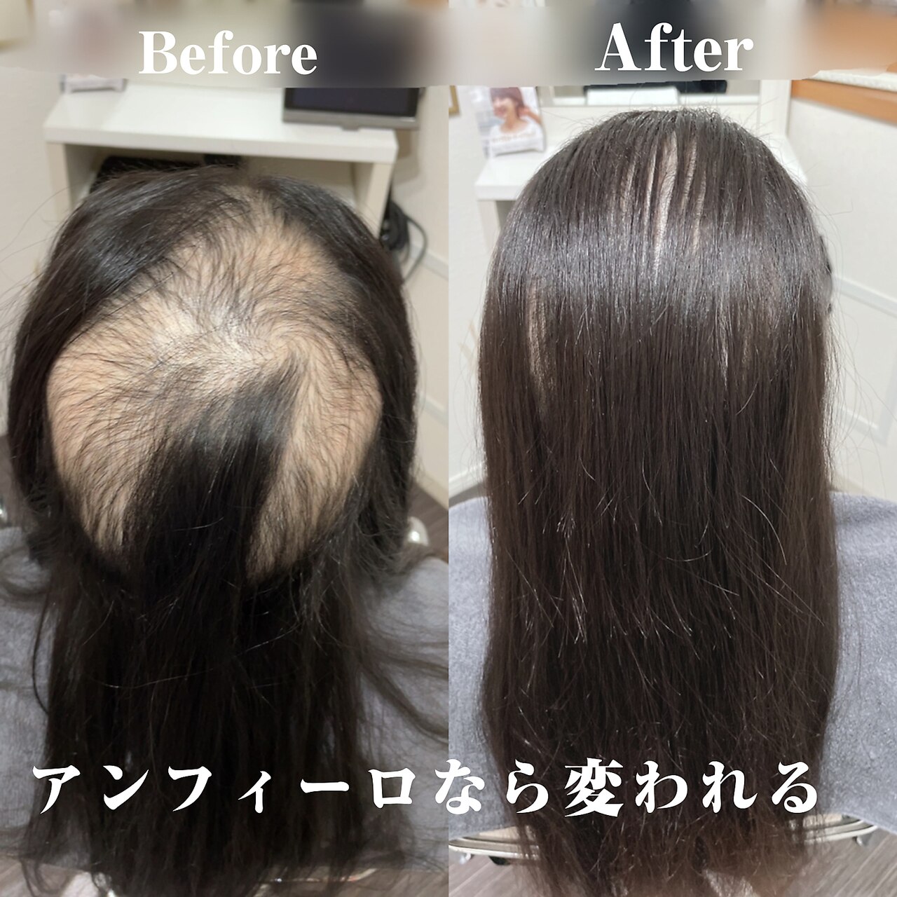 増毛エクステ(ヘアループ)2000本：L028893095｜アンフィーロ(An filo