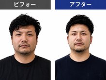 男一本 アトムズ(AtomZ)の雰囲気（骨格補正スパは頭、首、フェイスラインが気になる方におすすめ◎）