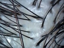 【after】ヘッドスパで改善した青白い健康な頭皮