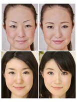 アガール&nbsp;黄金比メイク　ビフォーアフター