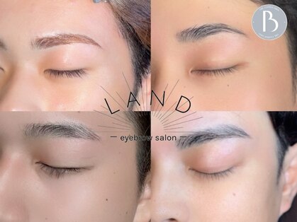 アルコ(ALCO)の写真