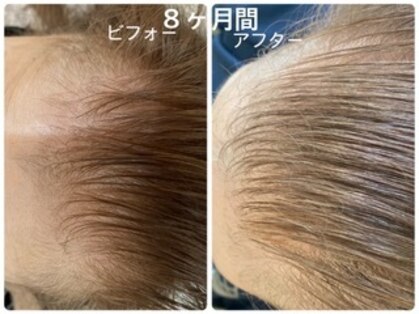 ヘアーブルーム(hair bloom)の写真