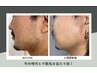 【男性の方にオススメメニュー！】カット＋お試しセルフ脱毛20分