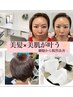 中間染め×“エクソソーム”美肌ケア◎お写真掲載可の方￥14,000⇒￥３,０００