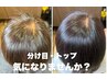 【女性限定】分け目・トップが気になる方へ|カウンセリング+施術体験