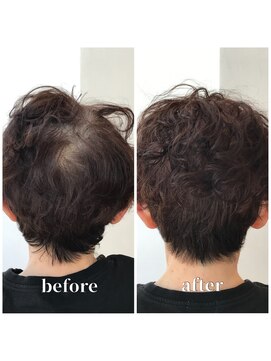 ビート(BEAT) ショート