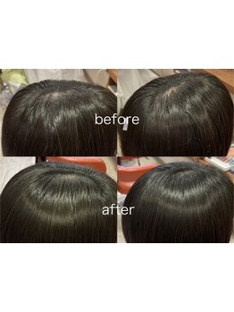 自分へのご褒美に贅沢スパタイムを♪小規模サロンならではの癒し空間で極上のひとときをお過ごしください◎