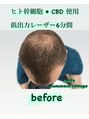 カシータ(casita)&nbsp;今、話題になり始めているCBDを使った育毛促進技術！！