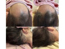 リンネ(Linne)の雰囲気（抜け毛予防改善メニュー毎月５名様モニター募集中です。）