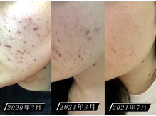 しっかり結果が出る！…大人気『CLALAシリーズ』