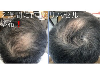 バーバーサンハチ(BARBER 38)の写真/大人のエイジングケア理容室で頭皮改善&肌質改善!5年後10年後の未来へ導くリバースエイジングへ◎