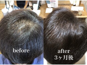 ロゼオ(Roseo)の写真/豊富な頭髪育毛促進メニューで頭皮ケア☆気になる髪のボリューム改善や、ハリコシを強くします!