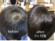 ロゼオ(Roseo)の写真/豊富な頭髪育毛促進メニューで頭皮ケア☆気になる髪のボリューム改善や、ハリコシを強くします!