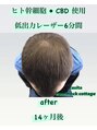 カシータ(casita)&nbsp;ヒト幹細胞&CBD＆低出力レーザーで育毛促進期待できます★
