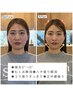 【インスタで大人気】骨格補正スパ￥14,000