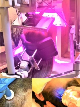 縮毛矯正専門店 アンジュ(ange)の写真/【毛髪促進専門プログラム】プロセルセラピーズ×皮膚学会推奨「近赤外線」《灘区王子公園》
