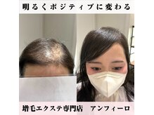 アンフィーロ(An filo)