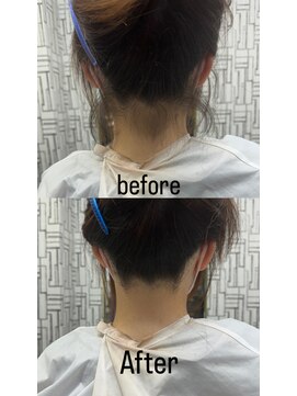 アローズ 久留米店(arose) うなじの産毛処理に困ってある方