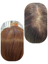 ユーフォルムギンザ(y-Forme Ginza)&nbsp;話題のトキカタ♪頭頂部編