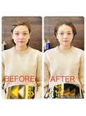 骨格補正スパ　before/after