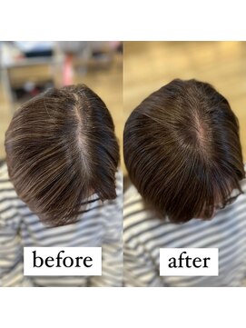 シンズ 仏生山店(SHIN'S) オシャレ染めで白髪染め