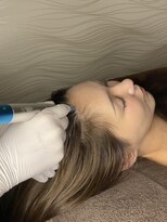 グレースフィオーレ 苫小牧店 グレースグロウセラピー