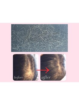 話題沸騰【白髪抜き30分\3200】【増毛エクステ100本\2700】40代女性に大人気の若見えサロン☆