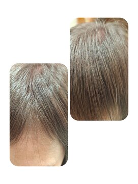 ユーフォルムギンザ(y-Forme Ginza) 話題のトキカタ♪前髪編