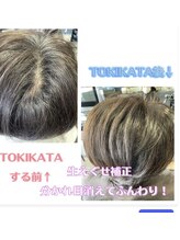 前髪や根元の癖が気になる！【トキカタ(TOKIKATA)】がおすすめなお悩みは？[大津/トキカタ/生え癖矯正］