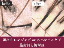 アイスタイル 西条西店(I STYLE)の雰囲気（白髪染めをしながら髪だけじゃなく頭皮もケア［頭皮改善/白髪］）