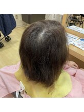 SORA縮毛矯正こだわり４