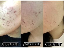 継続するからこそ肌に差が出る｜CLALAシリーズ