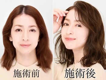 ヘアー クリアー 牟礼本店(hair clear)の写真/今までの白髪染めではできなかった明るく透明感のある白髪染め◎白髪ぼかし/白髪染めハイライトもお任せ♪