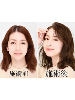 今までの白髪染めではできなかった明るく透明感のある白髪染め◎白髪ぼかし/白髪染めハイライトもお任せ♪