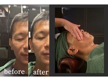 "目がパッチリした"と好評！キュッと引き締まった精悍な顔つきへ