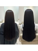 シンシア 銀座(sinsia)&nbsp;20代　綺麗を維持するなら半年周期のストレート！