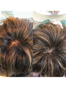 あさひ 白髪染めのループから開放する新しい白髪を活かすカラー　2