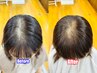 【新大久保】増 毛 エクステ【前髪が少ないのが気になる人向け】200本コース