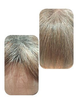 ユーフォルムギンザ(y-Forme Ginza) 話題のトキカタ♪前髪編