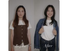 ビセラ(Vicella)