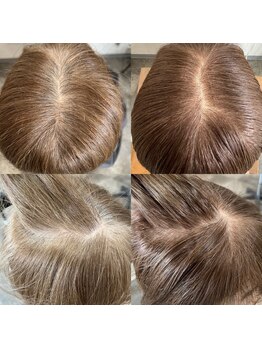 カーキヘアリンク(khaki hair link)の写真/◇新提案◇白髪染め不使用でダメージレス♪白髪を”隠す”ではなく、白髪を『活かした』カラーをご提案◎