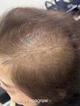 ロハスヘア バイ ノット(rohas hair by knot) ノアグロウスカルプ