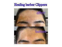 クリッパーズ(Clippers)