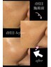【髪と肌のエイジング改善】全体染め+エクソソーム美肌ケア￥14,000⇒￥8,000～