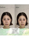 小顔メニュー