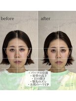 ロルド レーブ(Rold reve)&nbsp;小顔メニュー